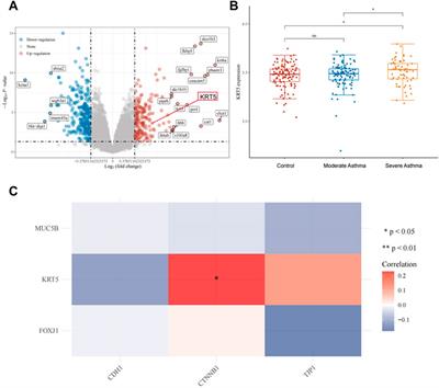 Avasimibe Alleviates Disruption of the Airway Epithelial Barrier by Suppressing the Wnt/β-Catenin Signaling Pathway